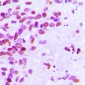 Anti-Estrogen Receptor alpha (pS106) Antibody